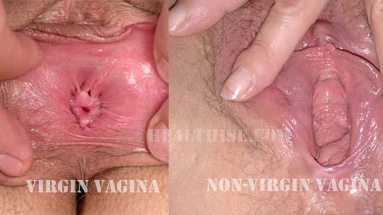 Virgin Pussy Photos